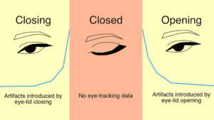 Highlighting the Challenges of Blinks in Eye Tracking for Interactive Systems
